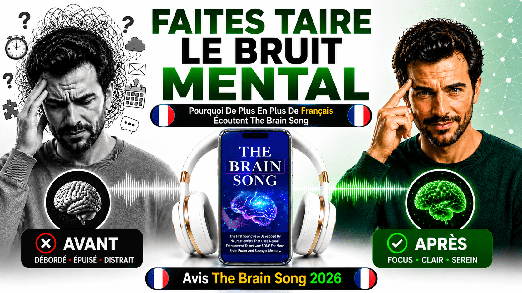 The Brain Song Avis France 2026